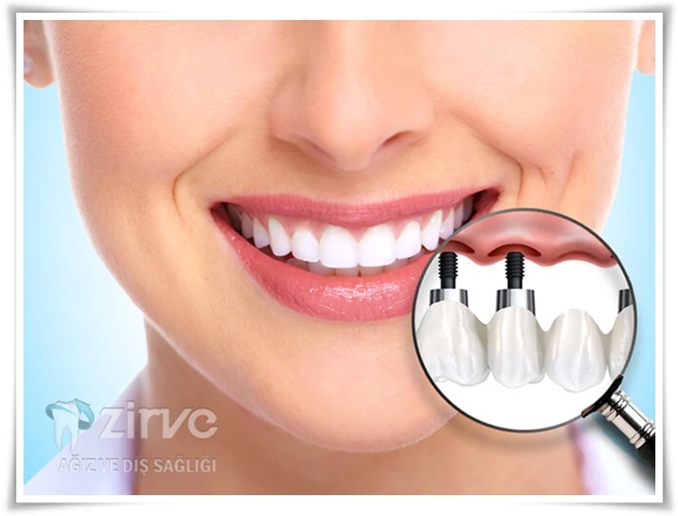 Ağız ve Diş Sağlığı Neden Önemli?